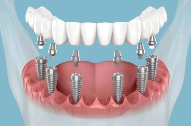 Sai Sudantha Dental Clinic, photo 3