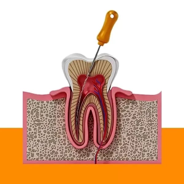 FMS DENTAL CLINICS - Vanasthalipuram, photo 2