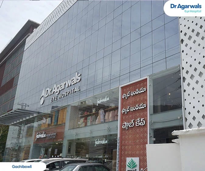 Dr Agarwals Eye Hospital, Gachibowli, photo 2