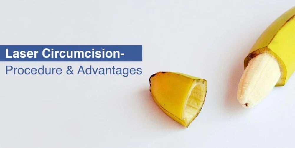 Circumcision, Urology & Kidney Stone Surgery Hospital, photo 2