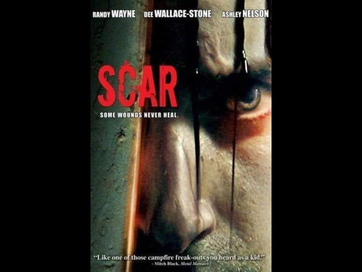 scar-999538-1