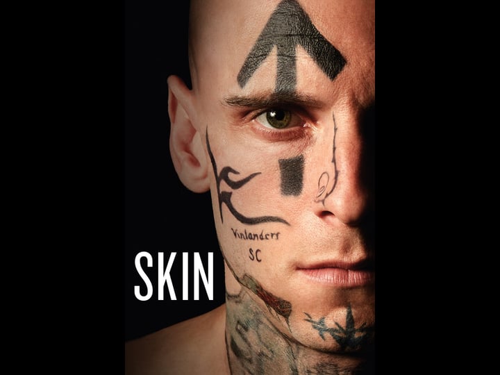 skin-tt6043142-1