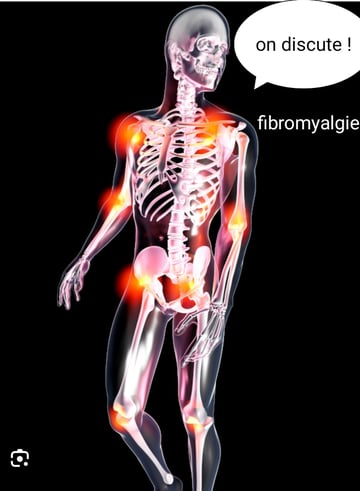 Fibromyalgie