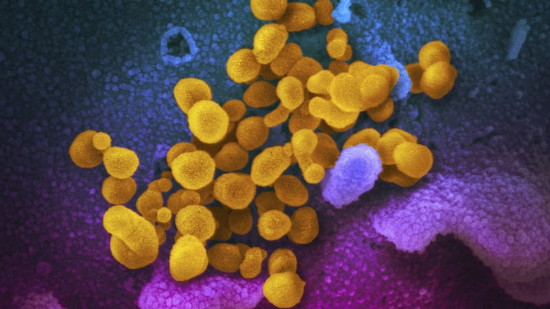 This electron microscope image shows the novel coronavirus SARS-CoV-2.