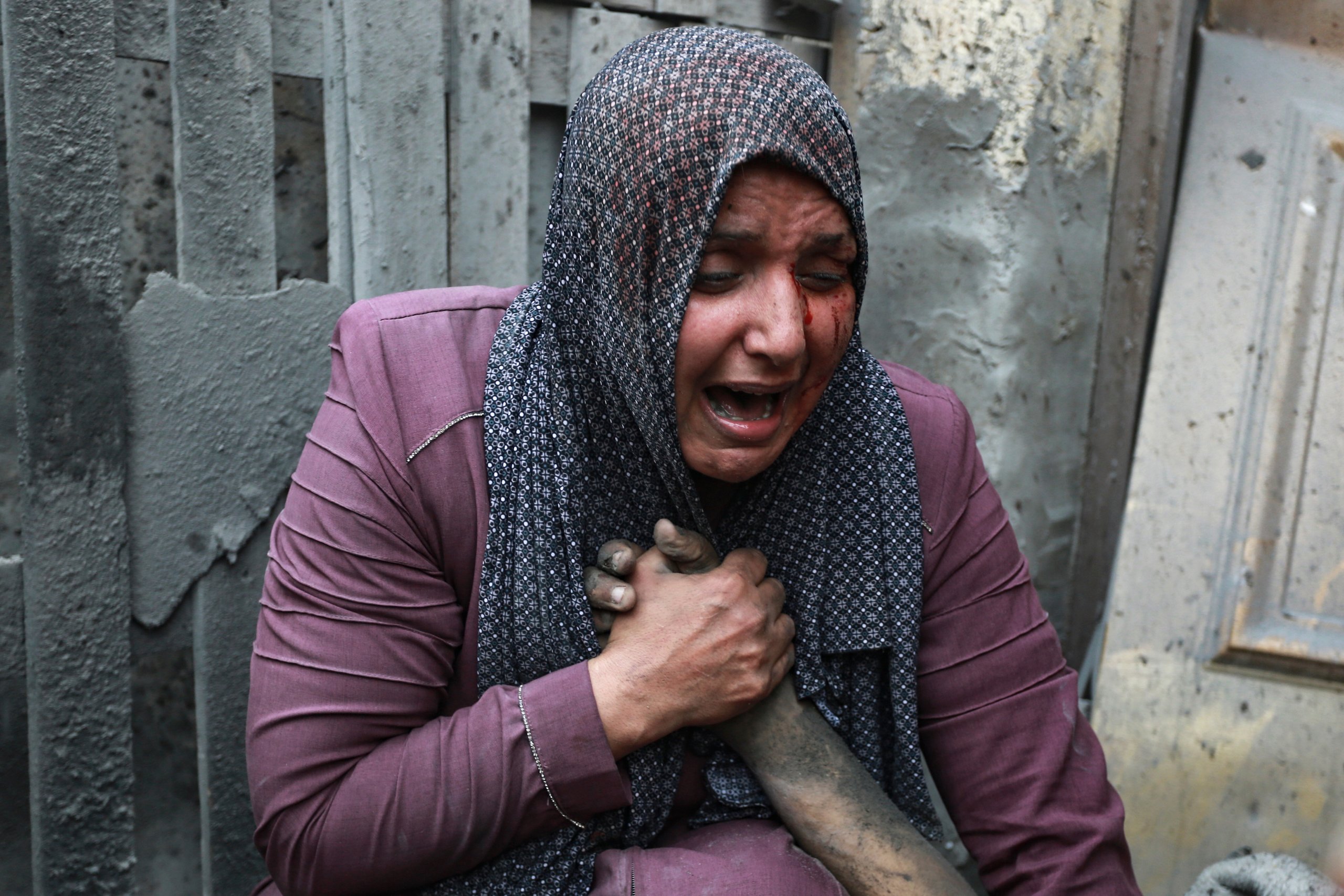 Alana Araya: The Emotional Toll Of The Leak - xm8ojv6