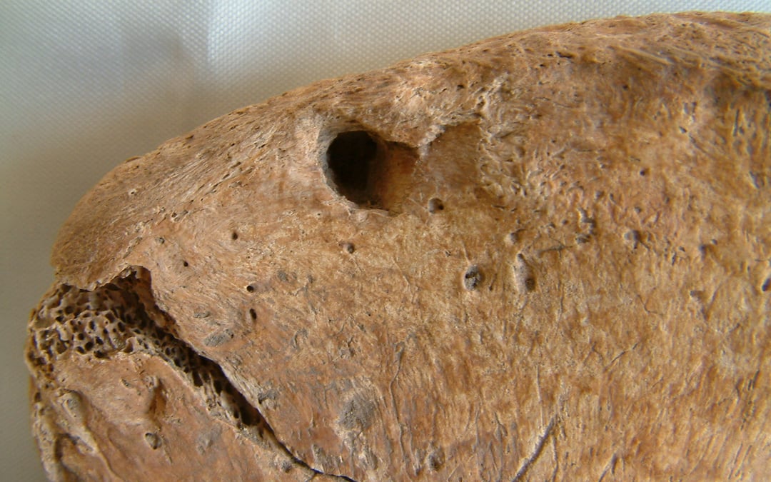 Lion bite on skeleton confirms Roman gladiator combat in ancient York