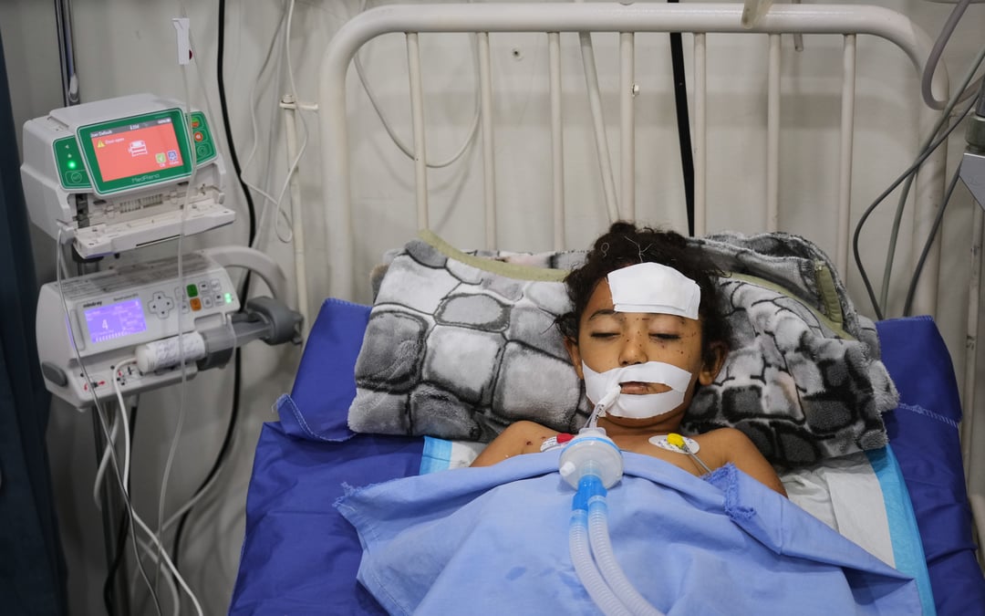 A bomb in Gaza’s rubble wounds twins who thought it was a toy