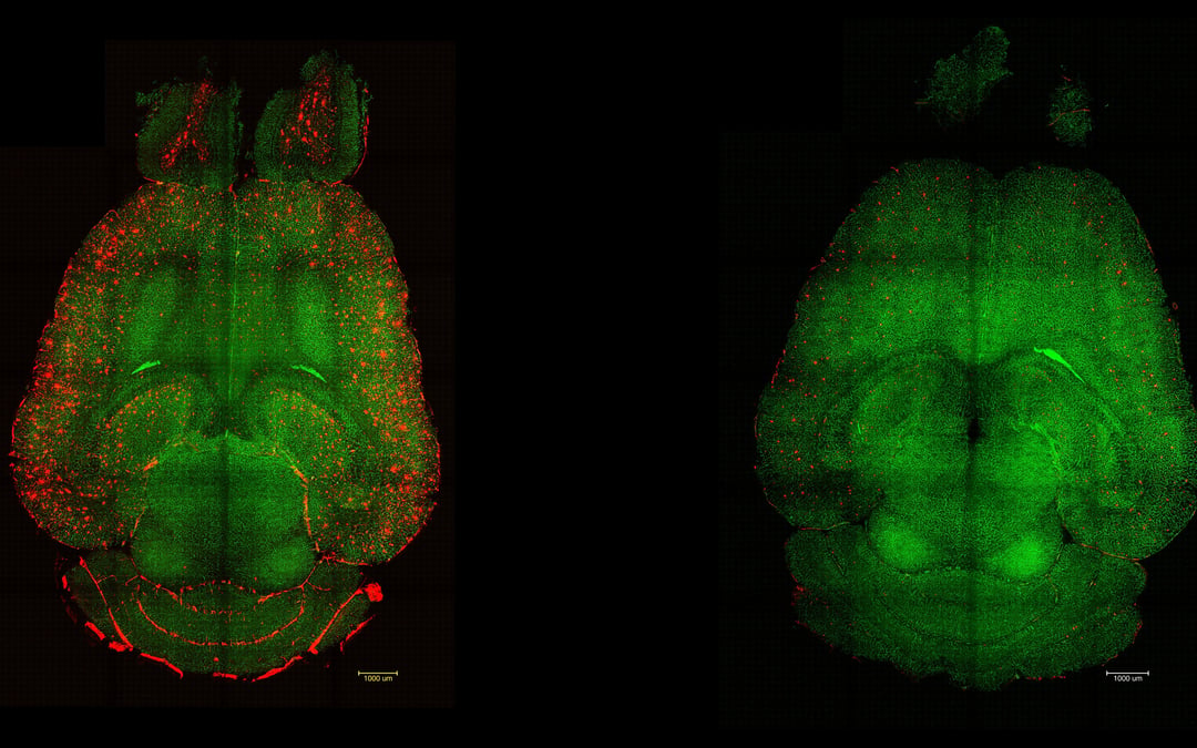 Scientists find new way to fight Alzheimer’s