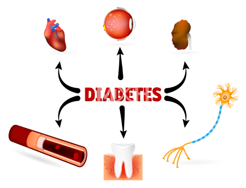Diabetes: Individualized Diet & Microbiome: A Need For Revision