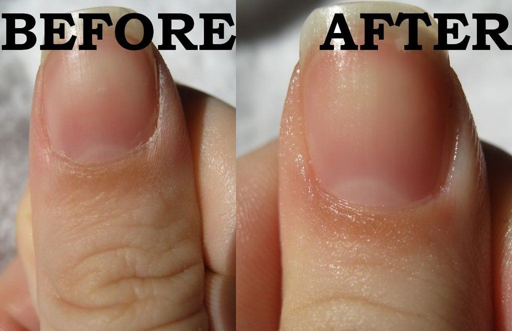 the image shows, before and after of russian manicure