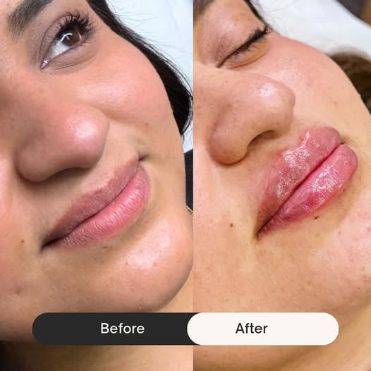 Treatment results