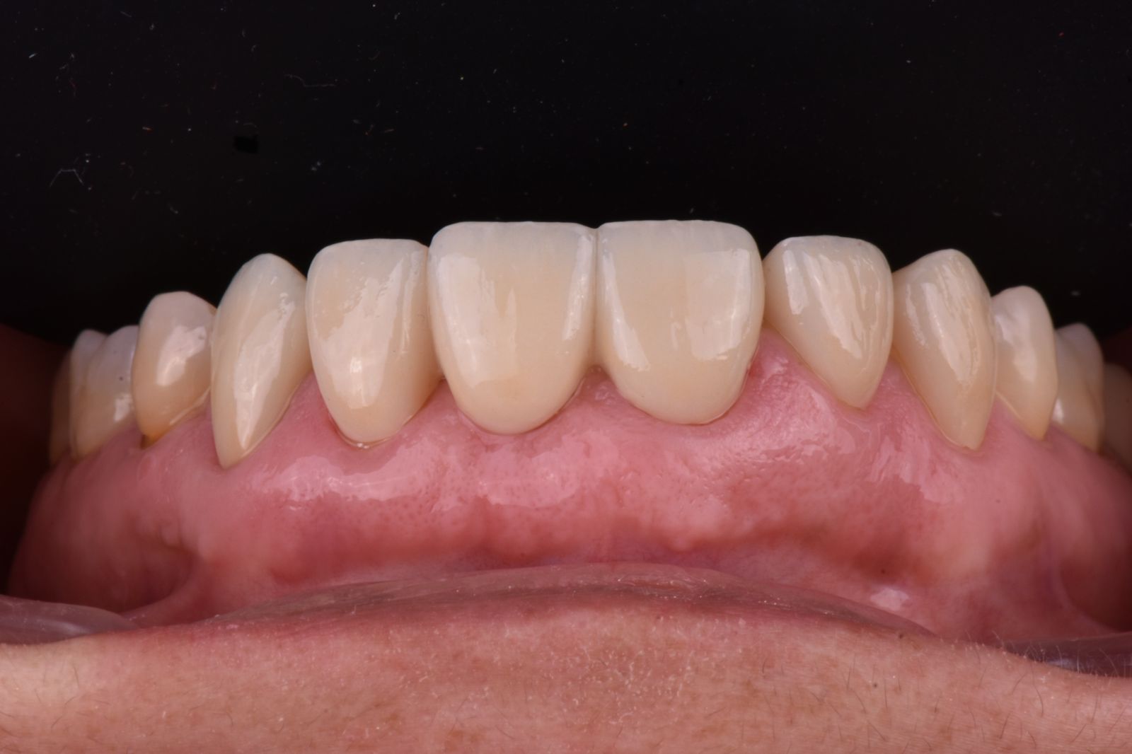 Rehabilitación Oral