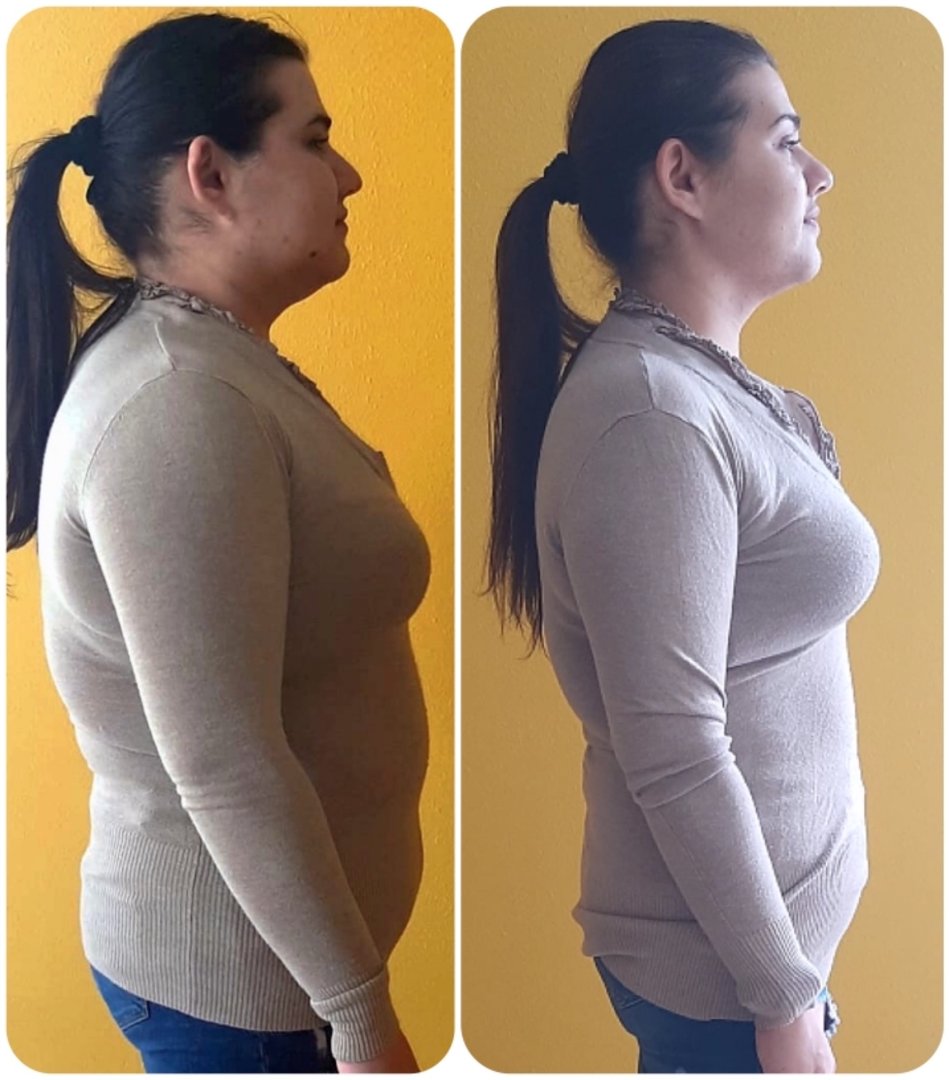 Trasformazione prima e dopo