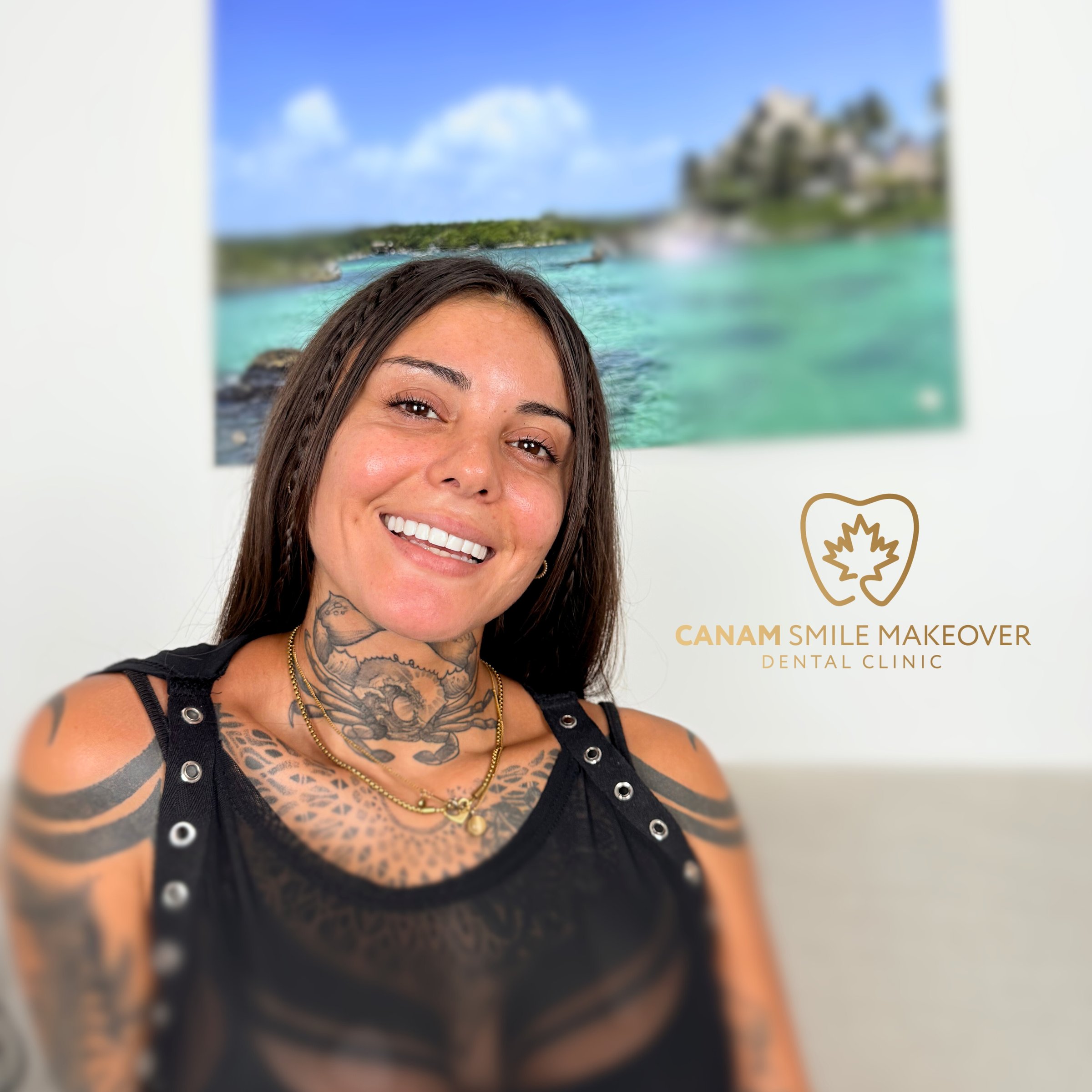 Restauración dental - Caso adicional