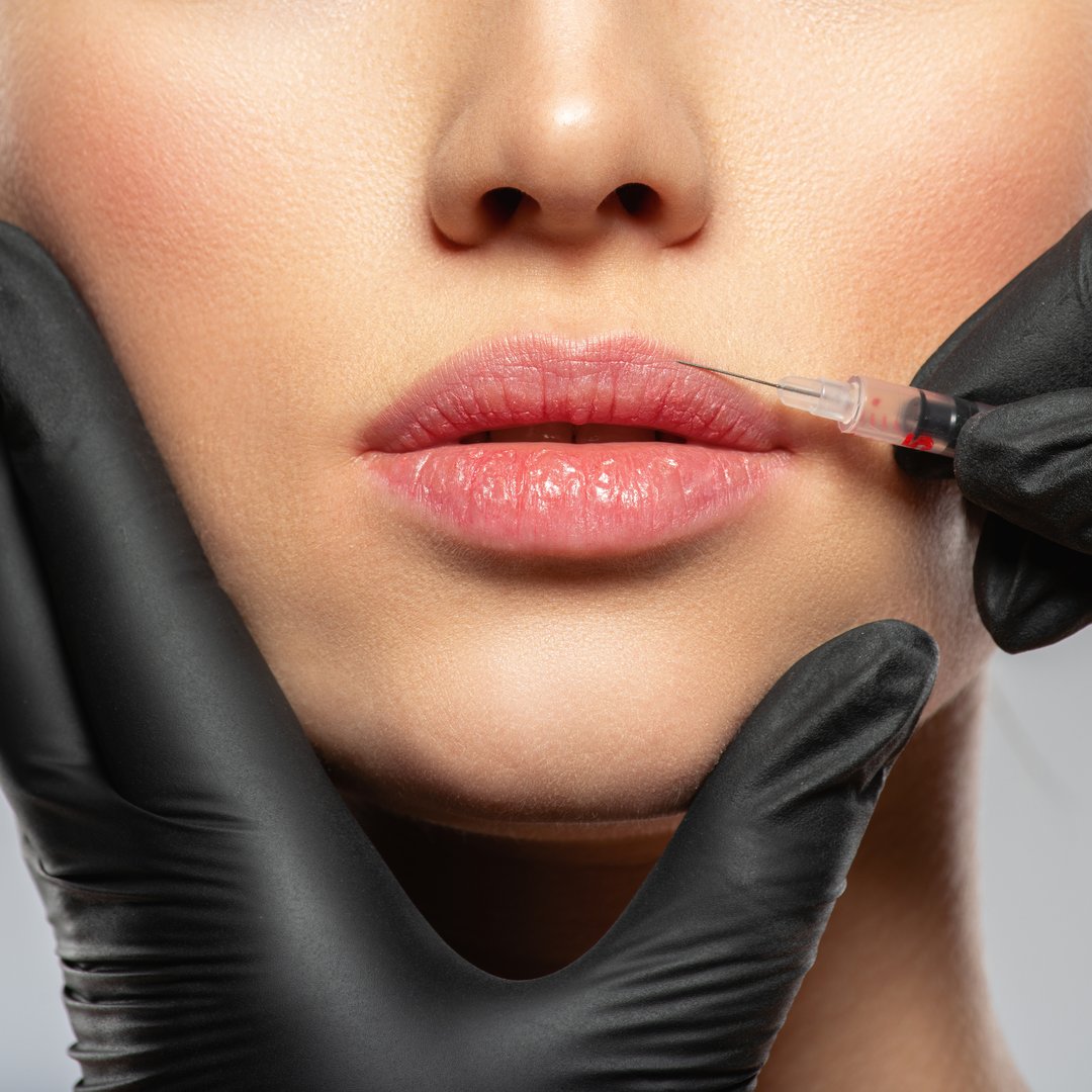 Young caucasian woman getting botox cosmetic injection in the lips. Beautiful woman gets botox injection in her face. Adult girl gets cosmetic injection of botox in a clinic. Beauty treatments