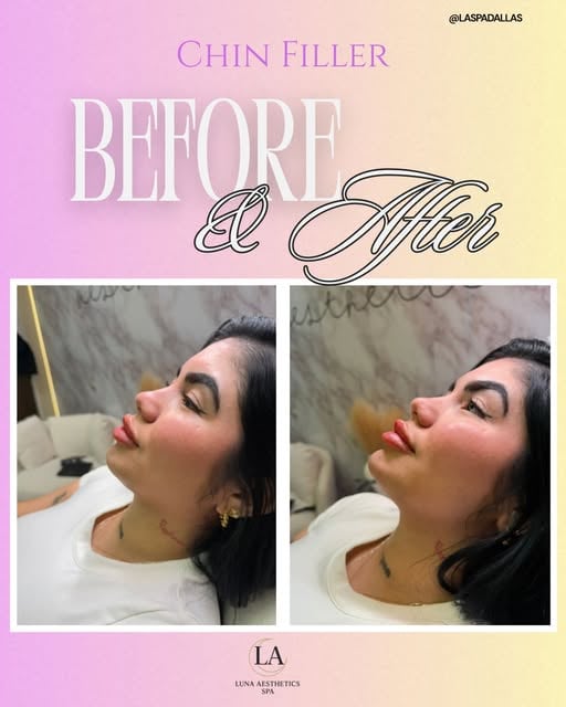 Treatment results