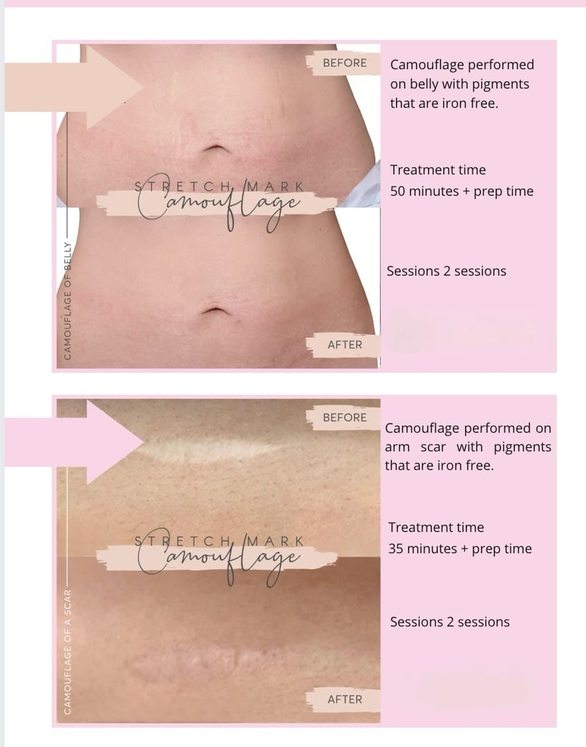 Scar treatment information and guidelines