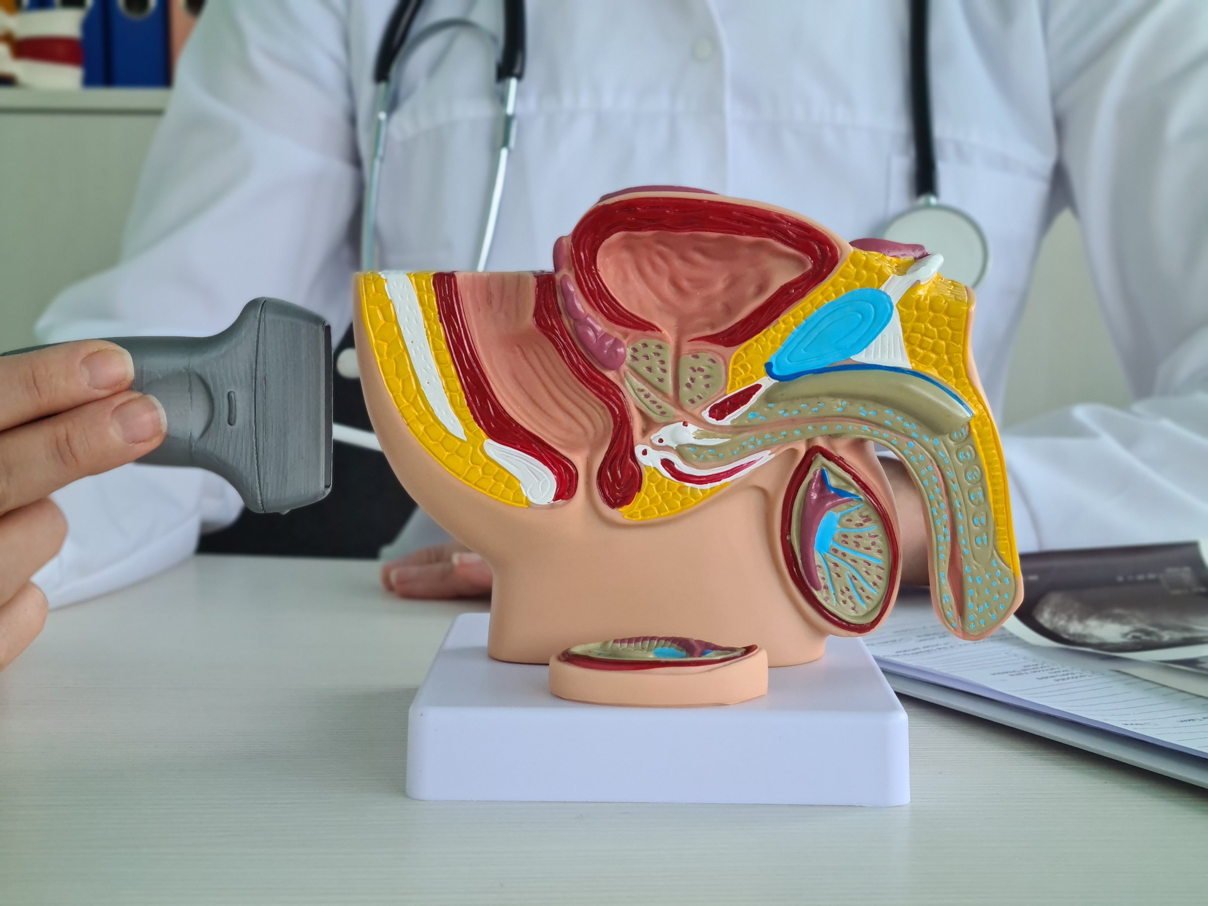 Transrectal ultrasound is vital for diagnosing prostate cancer and conditions. It involves a probe inserted into the rectum to examine the gland, aiding in detection and treatment of prostate issues.