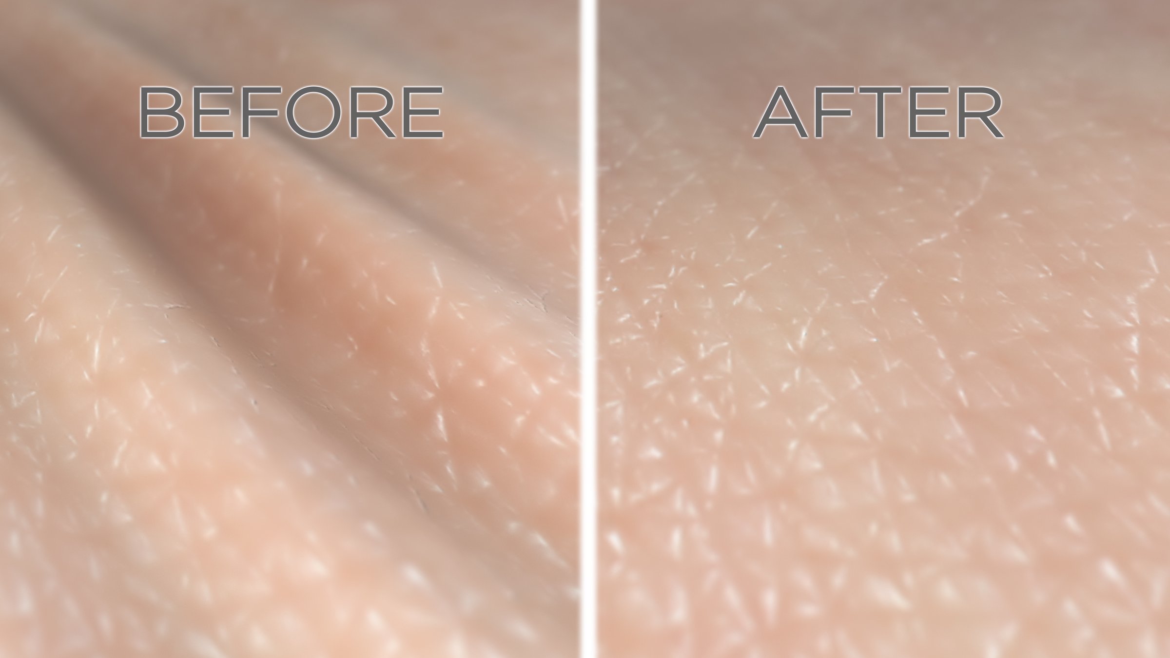 Human skin surface before and after wrinkle reduction treatment. 3D rendered illustration