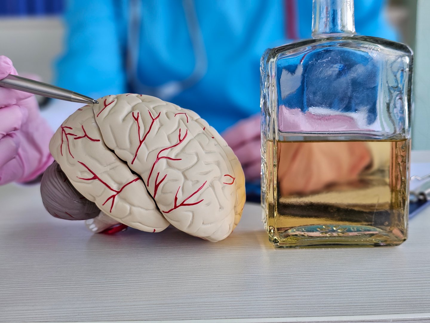 Anatomical model of the brain with alcohol in the hands of a doctor. Mental health alcoholism. Alcoholic encephalopathy causes, symptoms and treatment.