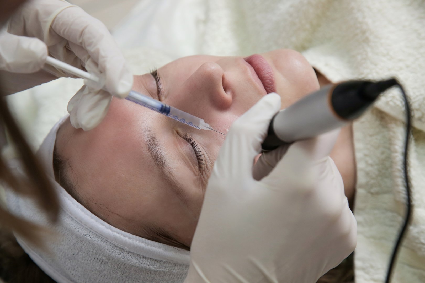 Mesotherapy. Woman having dermapen facial treatment. Micro needle cosmetic treatment at dermatologist.