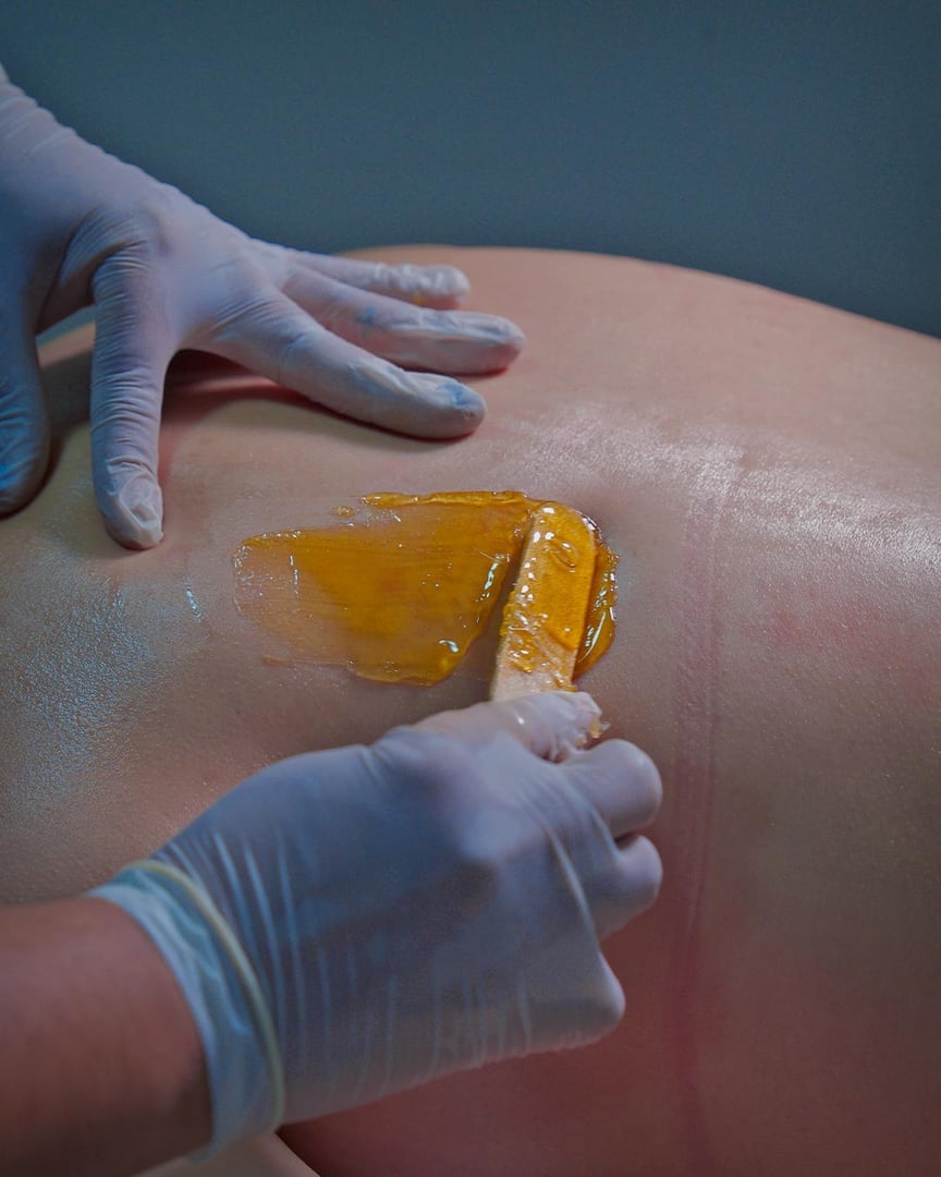 A person applies wax on skin with a spatula, wearing blue gloves, preparing for hair removal.