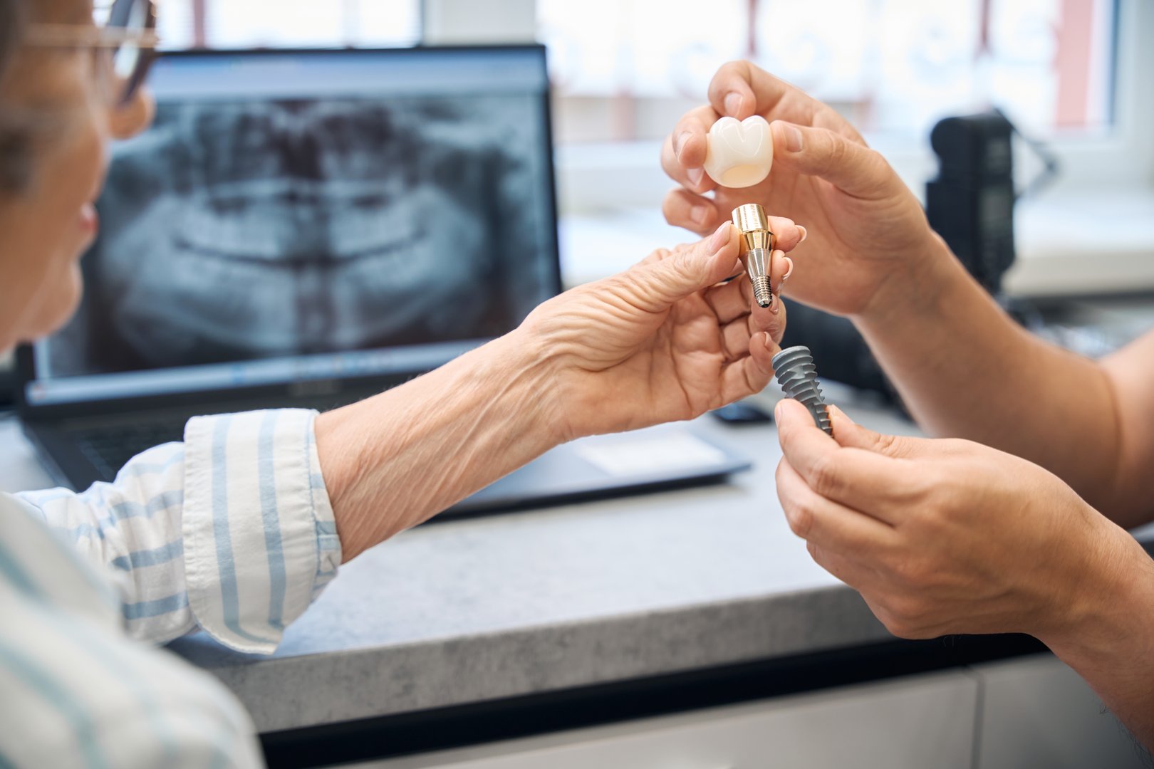 Prosthetist consults an elderly lady in a dental clinic, he shows her a model of a dental implant
