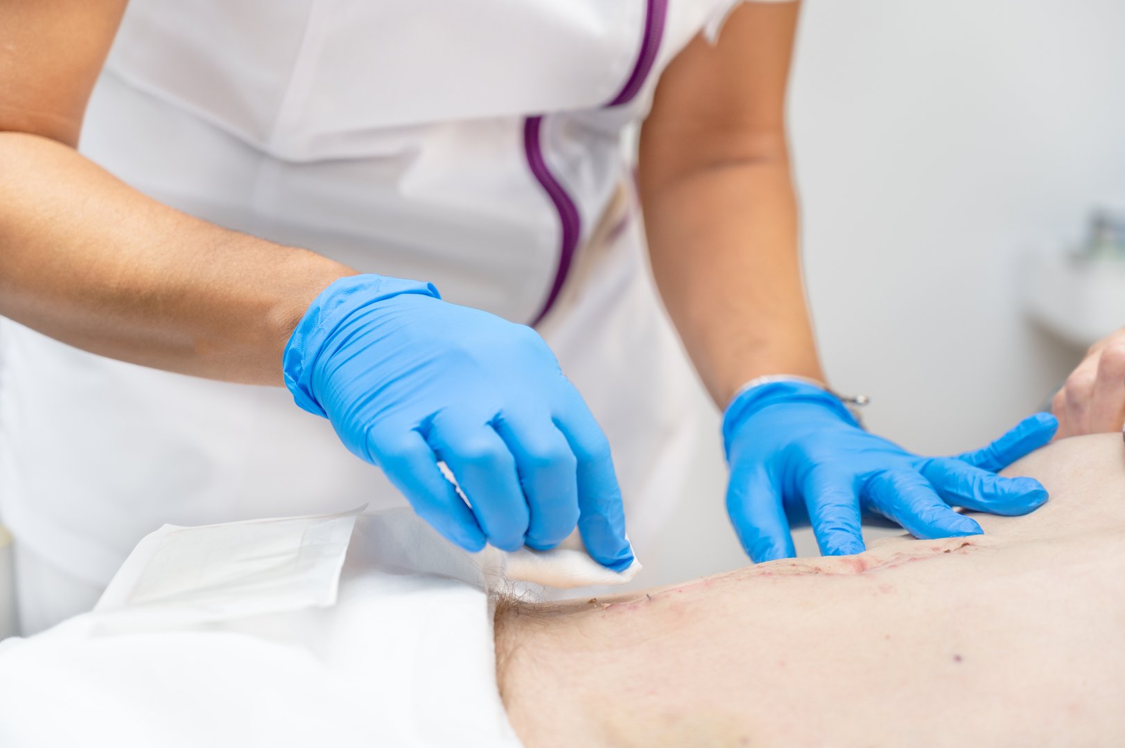 Close up of nurse's hand cleans and treats abdomen injury after surgery at the hospital. Surgical wound on the abdomen. High quality photography