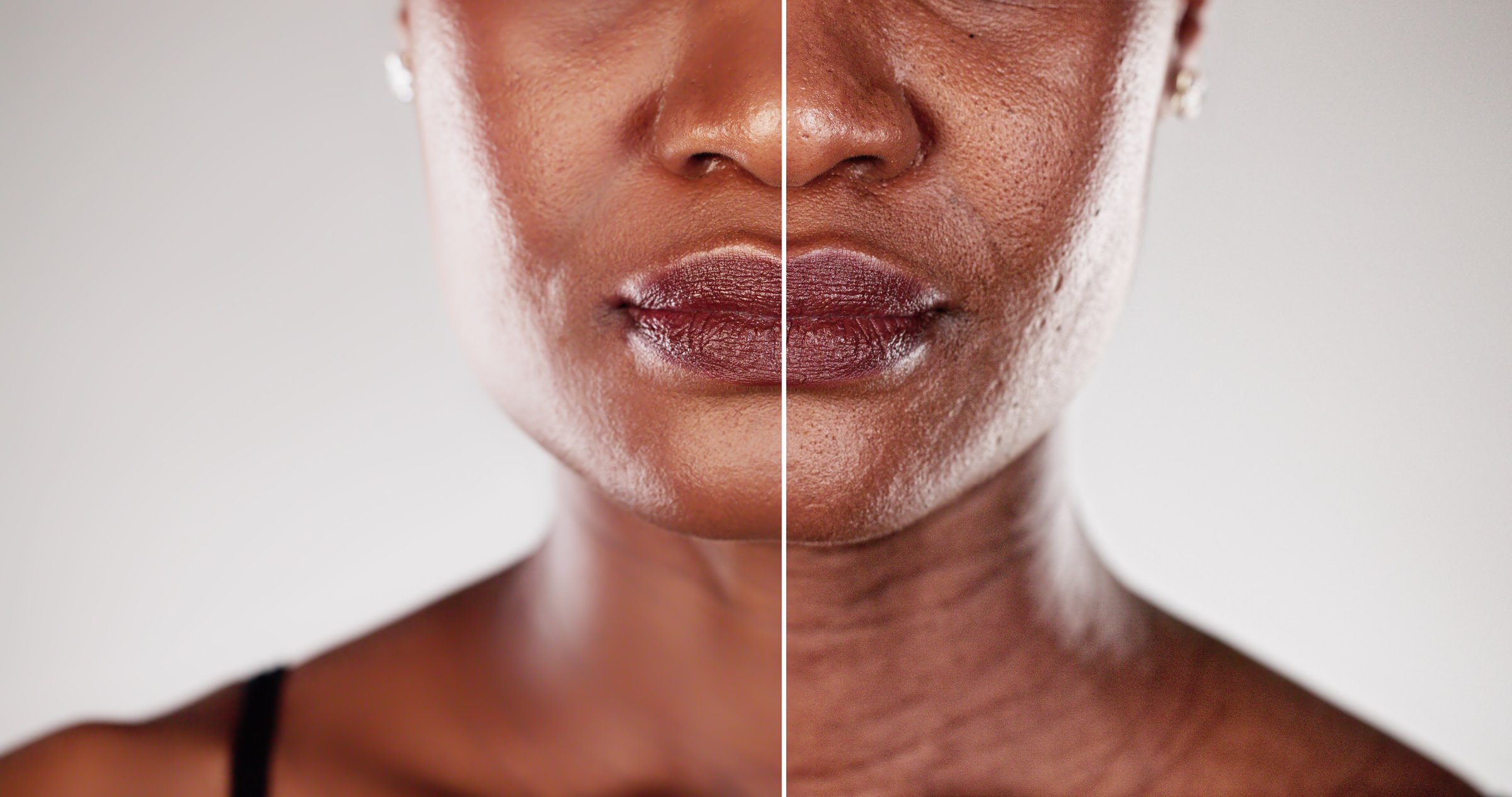 Transformation of a black woman's skin before and after a microdermabrasion facial treatment, showcasing the power of skincare.