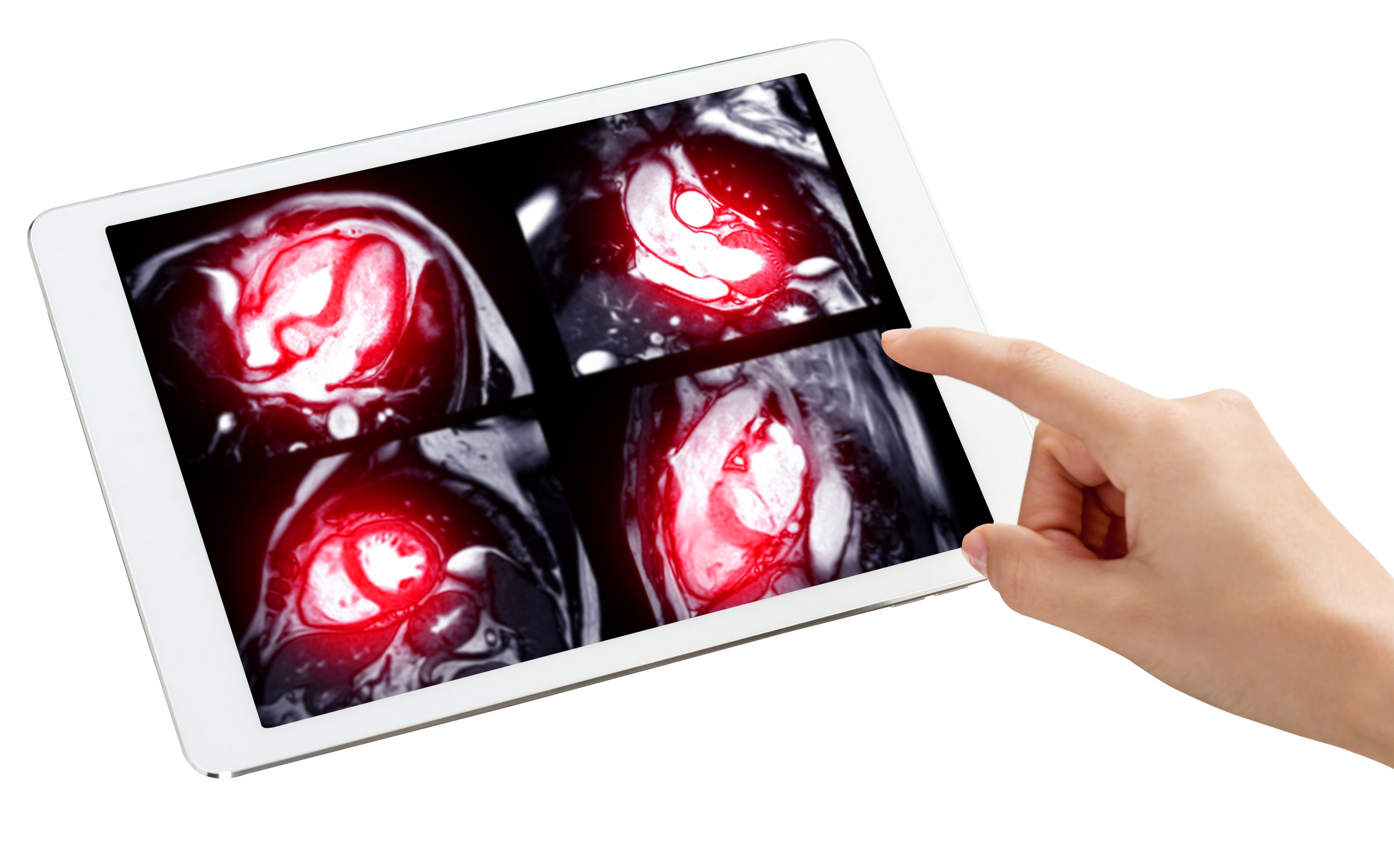 Futuristic MRA cardiac scan on tablet with hand pointing, representing AI-driven healthcare, advanced radiology, and modern diagnostic technology for cardiology.