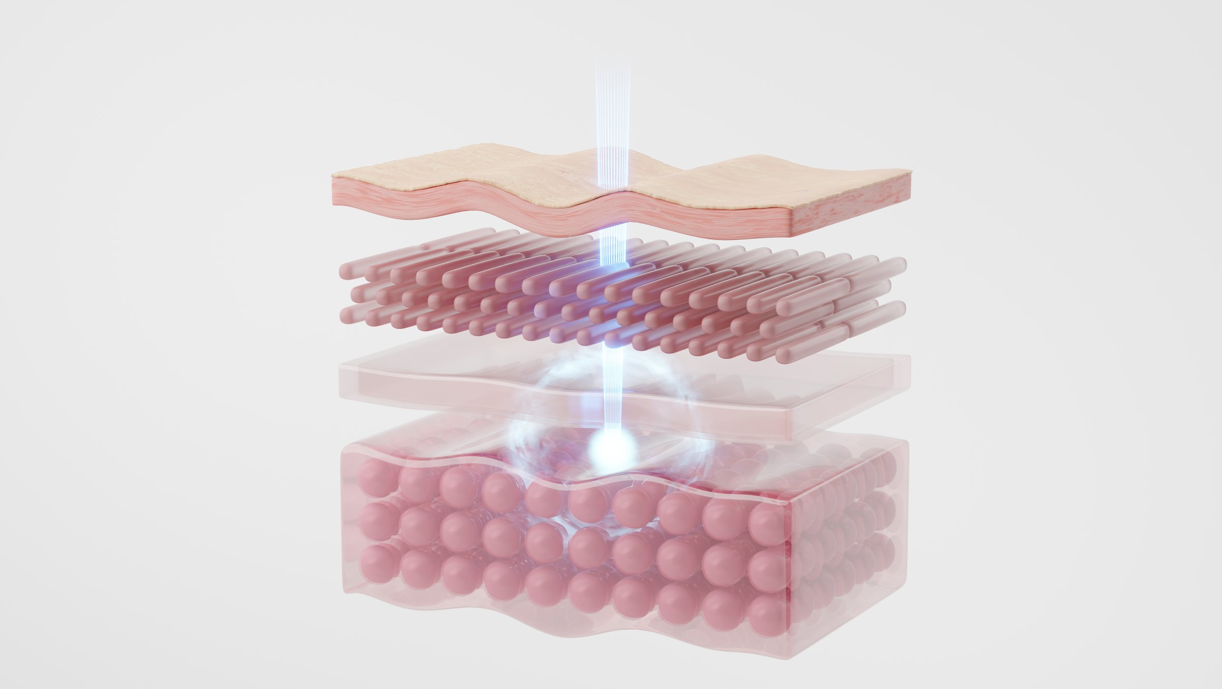 Laser light penetrating skin cells to SMAS, symbolizing skincare. 3D rendering.