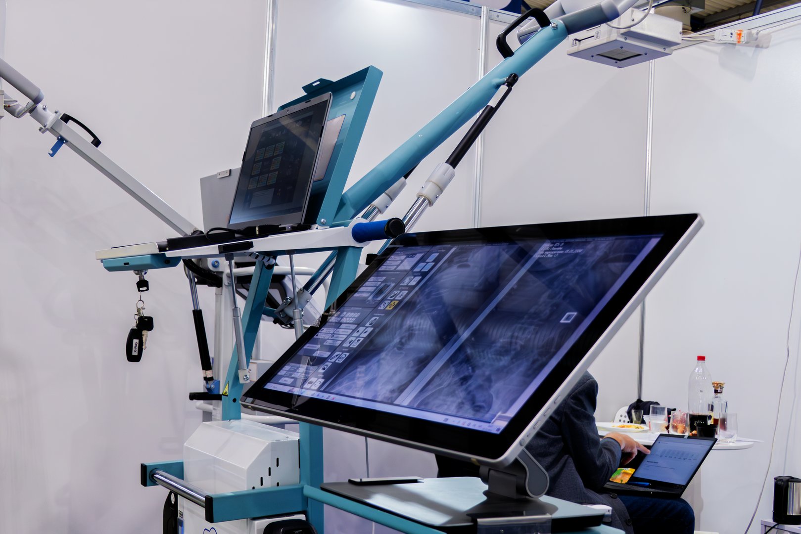 Modern portable X-ray machine with images displayed on a monitor