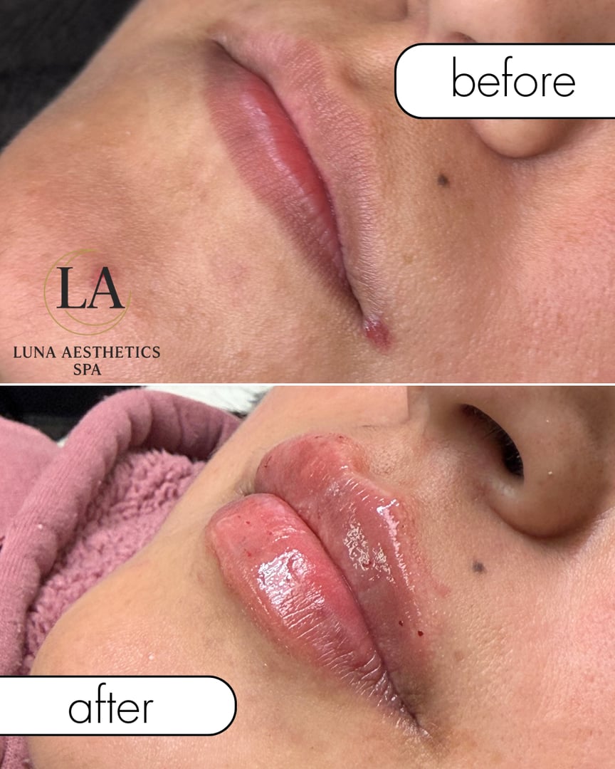 Before and after treatment results