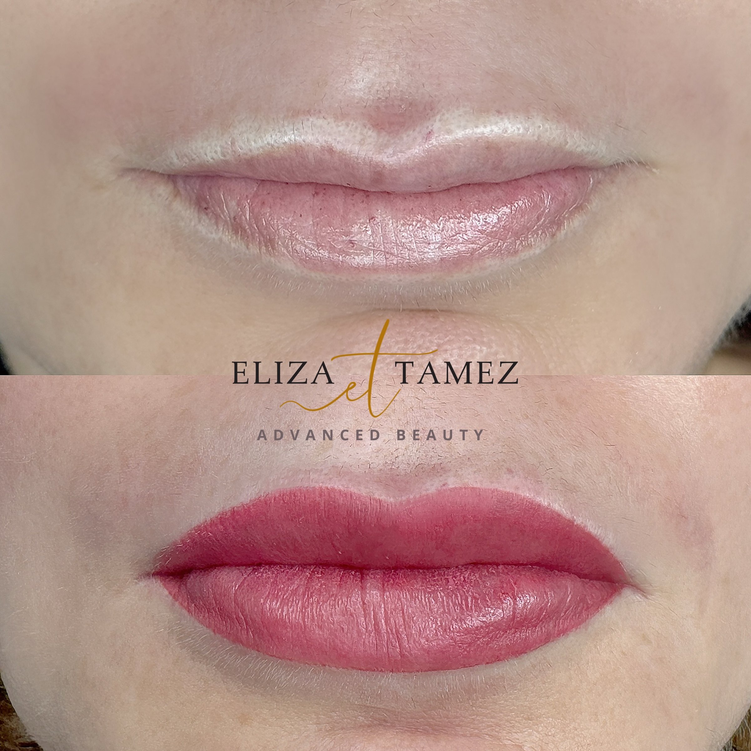 Labios - Color Natural