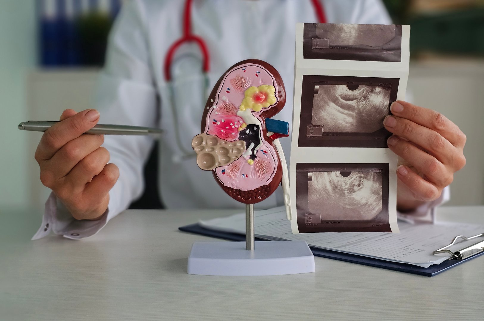 Medical professional examines kidney model and ultrasound images in clinic consultation