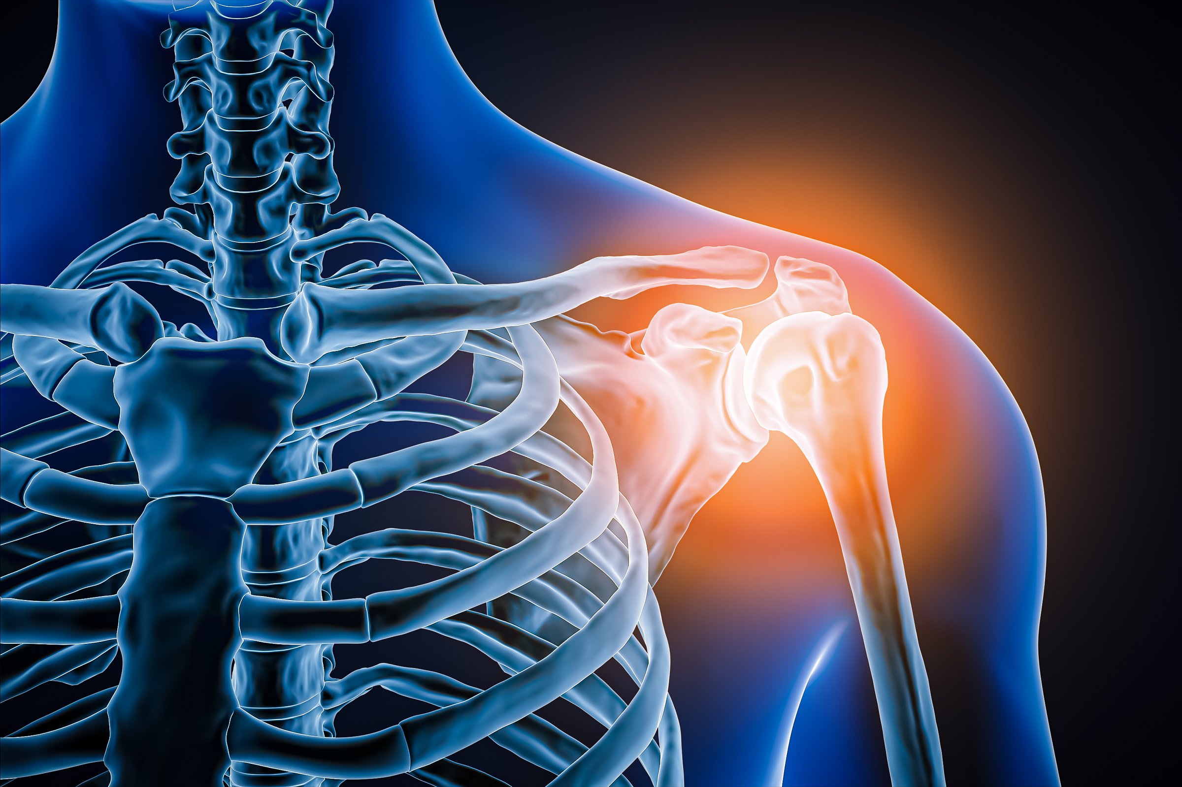 Shoulder joint inflammation 3D rendering illustration