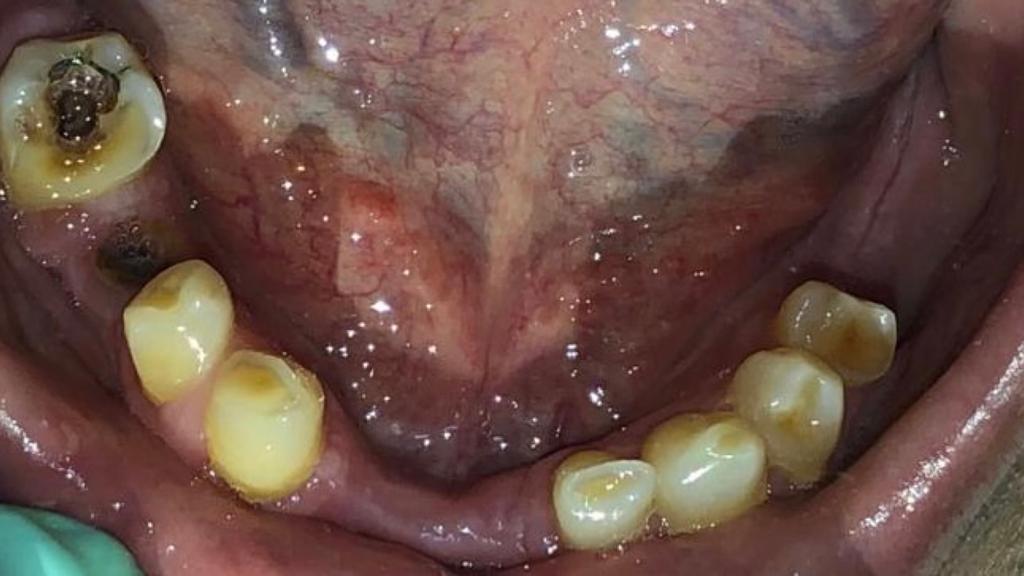 Fase 1: Diagnóstico inicial de rehabilitación oral