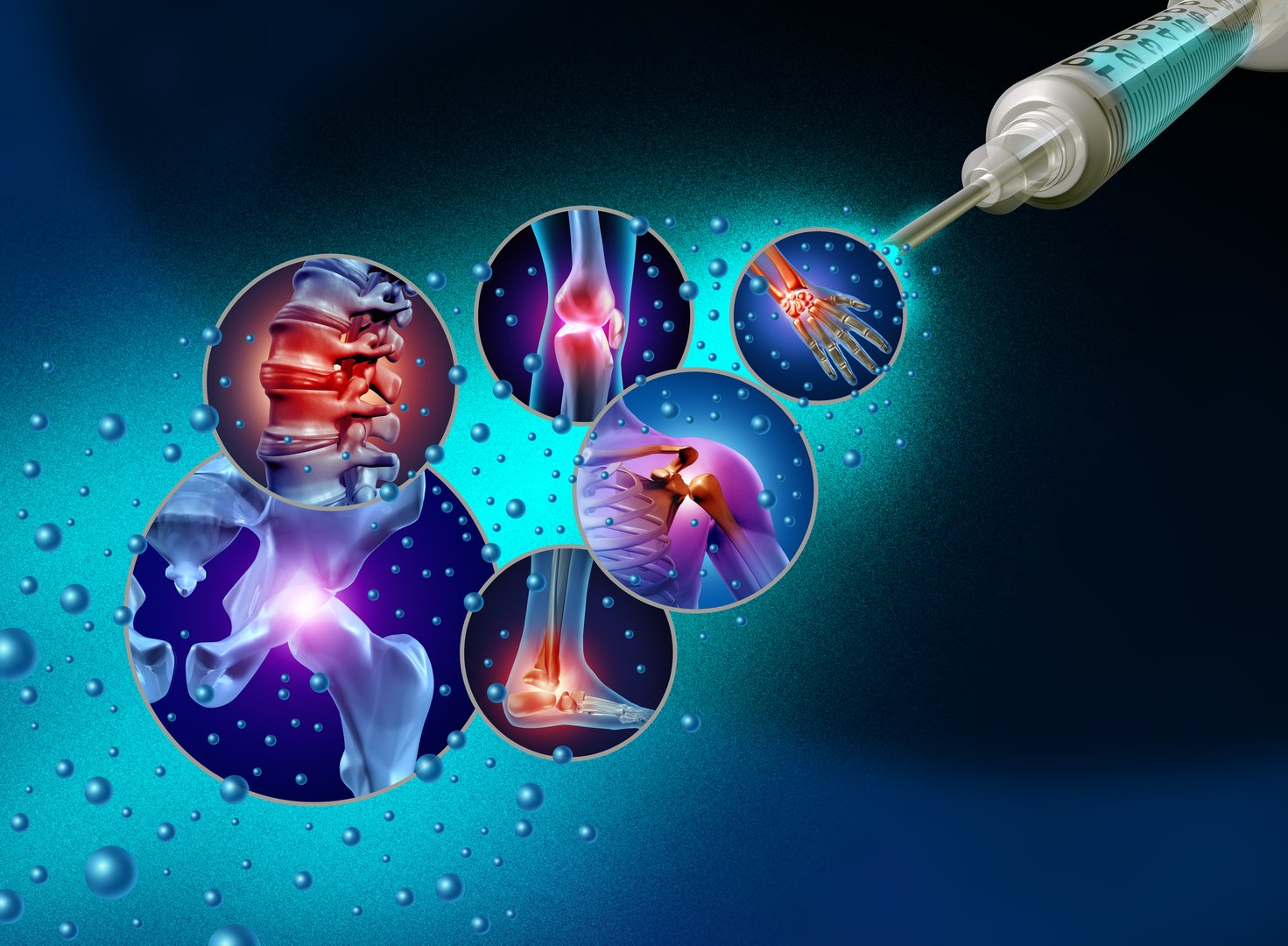 Regenerative Joint pain Medicine and Stem cell treatment or DNA biotechnology medication to repair joints and stop  degenerative aging as a multicellular embryonic cellular therapy.