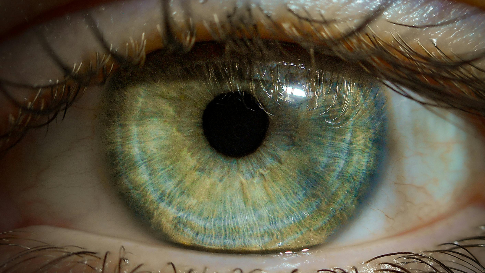 Iridology iris analysis