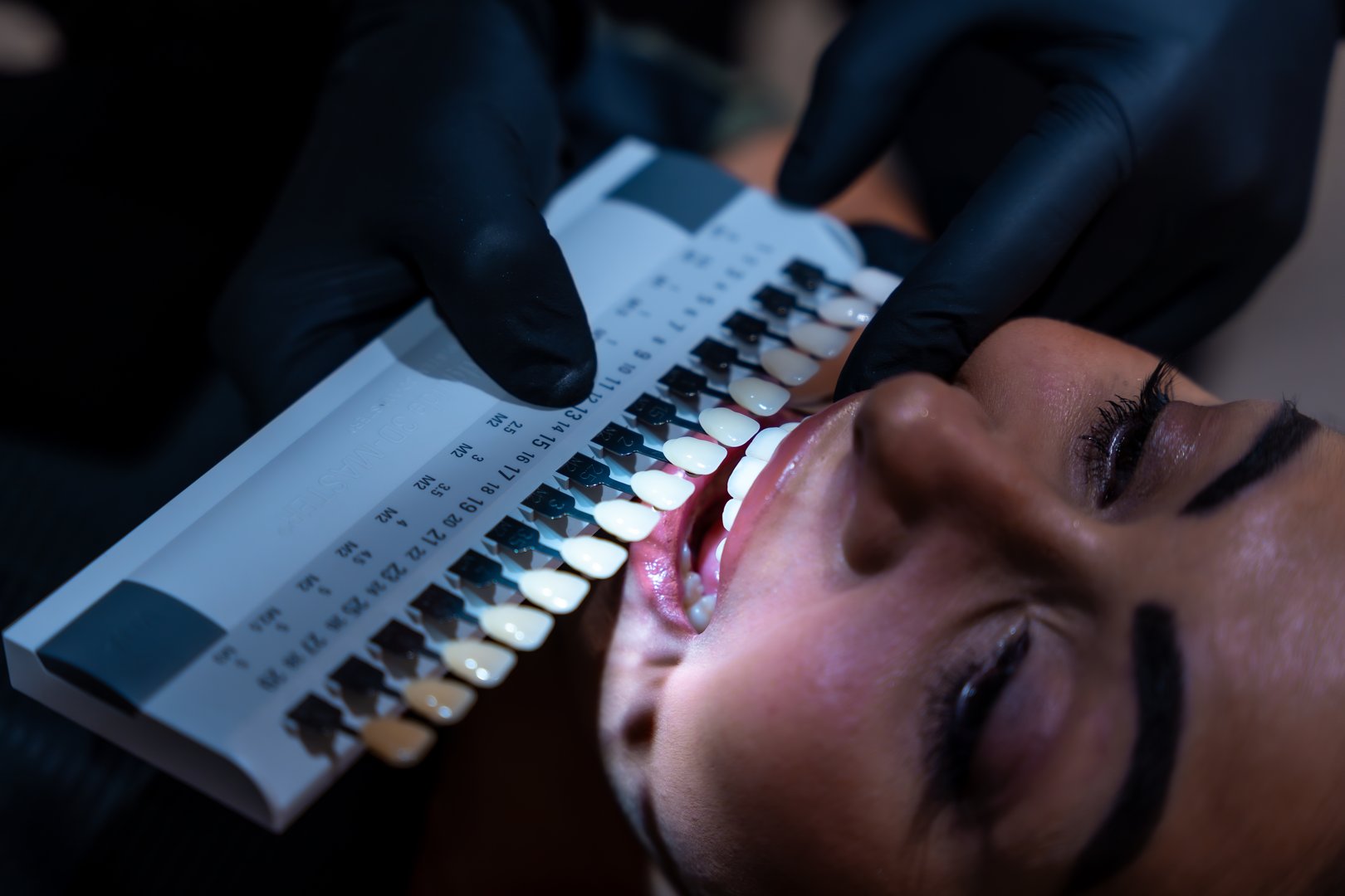 Dentist is comparing patient's teeth shade with tooth enamel color chart at dental clinic