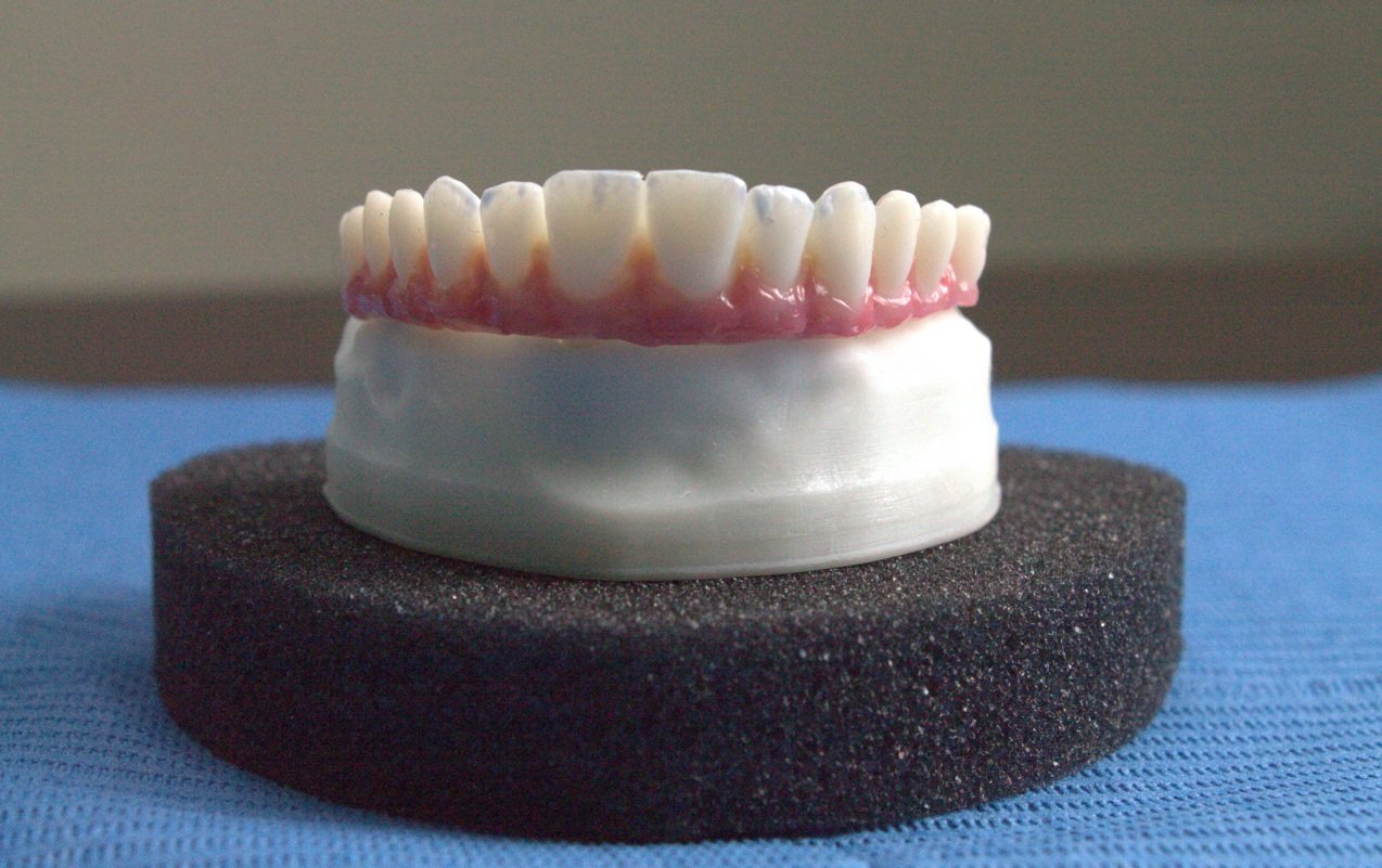 Prótesis Total completa dental