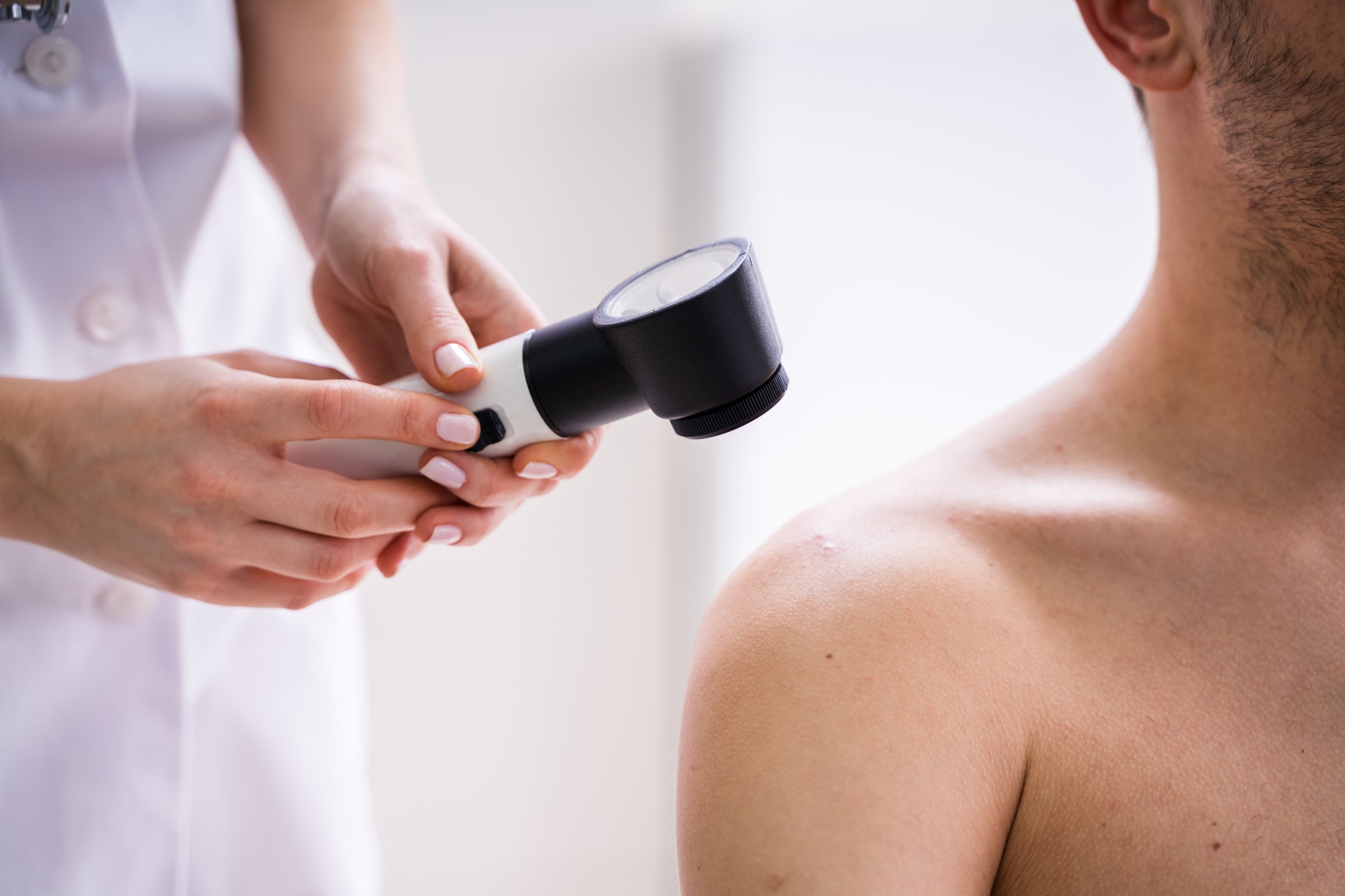 Close-up Of Person Hands Examining Acne Skin Of Man With Dermatoscope