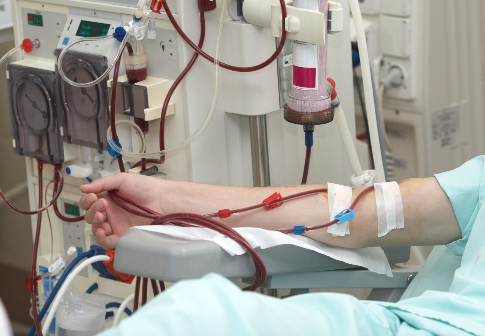 patient helped during dialysis session in hospitalpatient helped during dialysis session in hospitalpatient helped during dialysis session in hospitalpatient helped during dialysis session in hospital