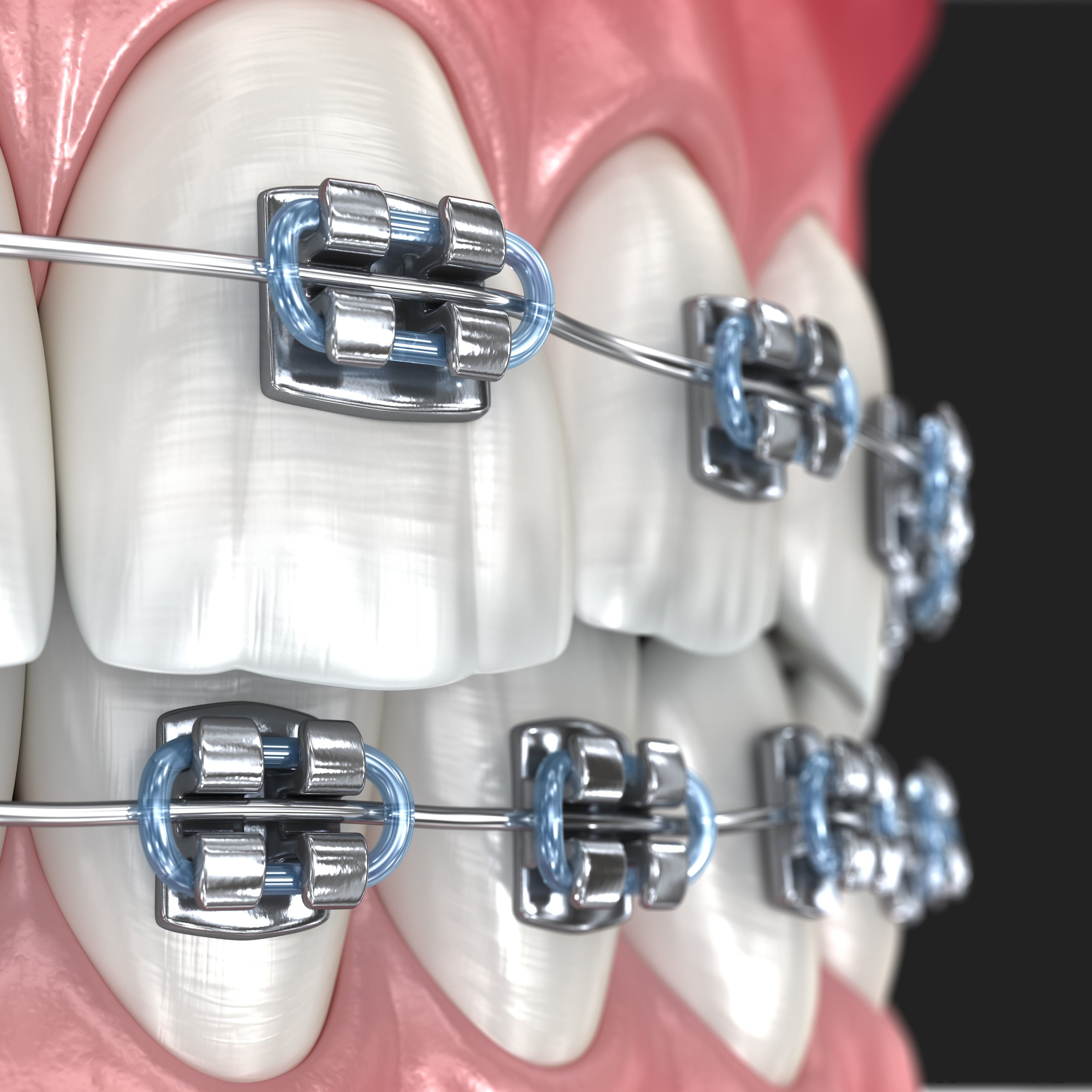 Metal braces on teeth, macro view. 3D illustration
