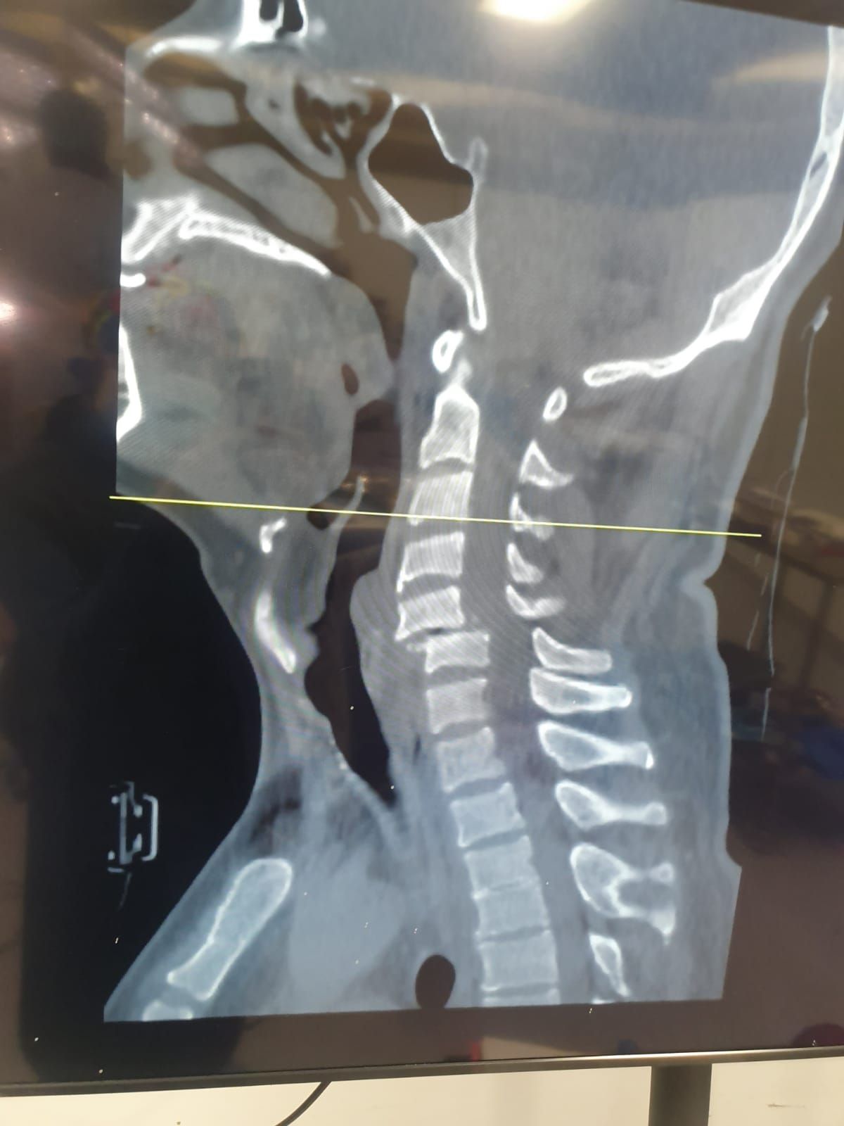 3D render of the spine and vertebral column designed for orthopedics, anatomy education, and healthcare materials, showcasing skeletal and structural details