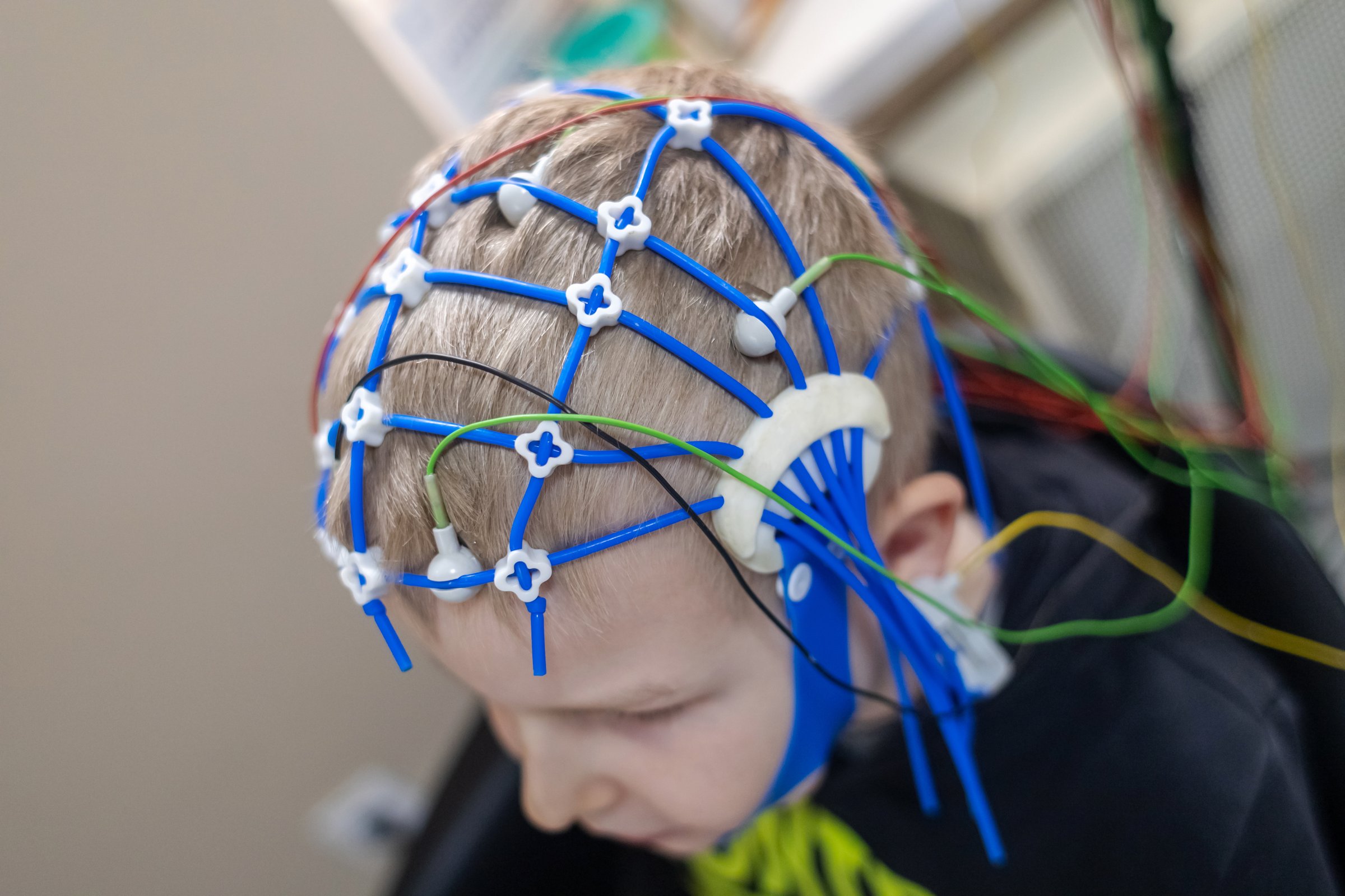 A boy's brain is examined on an EEG machine. Encephalogram for children. Electroencephalogram is performed in a hospital laboratory to detect neurological diseases.