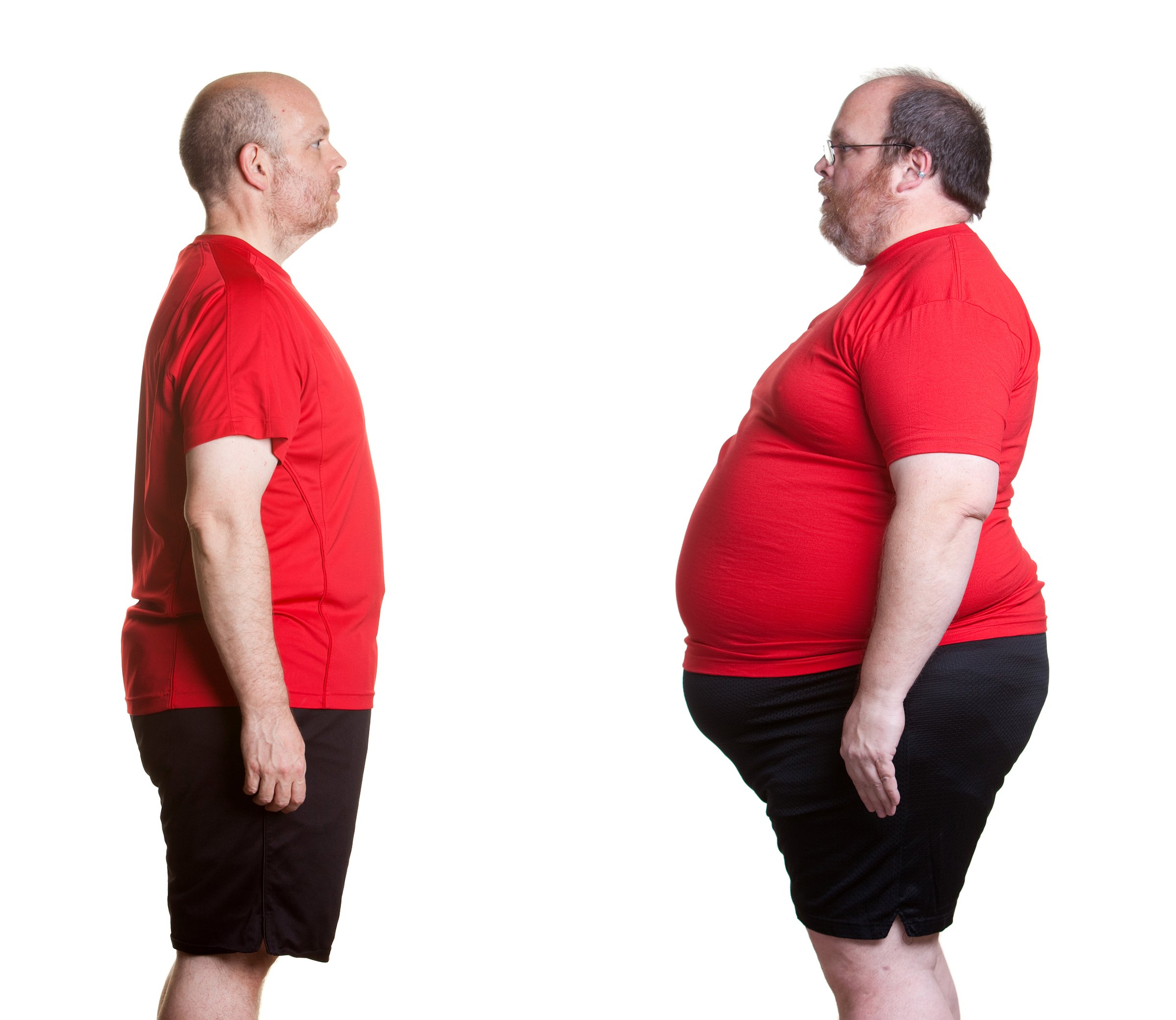 Before and after pictures of man with 16 months nutrition and exercise changes and losing 180 lbs.