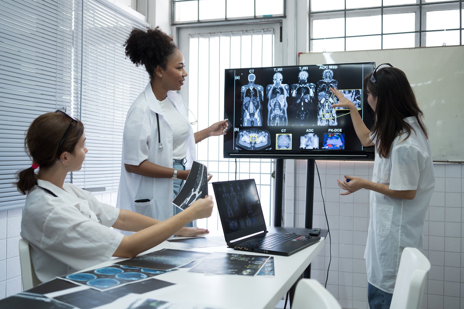 Group of female medical scientists meeting in brain research lab by monitor showing MRI, CT scans brain images. Group of doctors discuss treatment for brain patients, showing images on monitor
