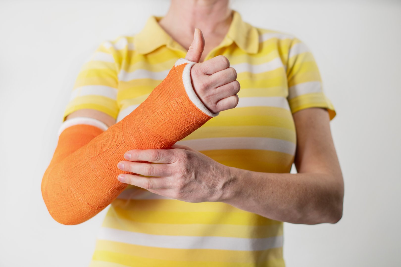 woman with a broken arm and an orange plaster plastic bandage on a white background,modern materials for the treatment of injuries,the latest medicine,copy space,High quality photo