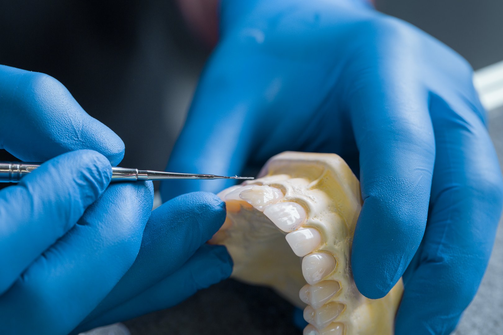 hand holding dental gypsum models of upper jaw, dental concept. Flapper